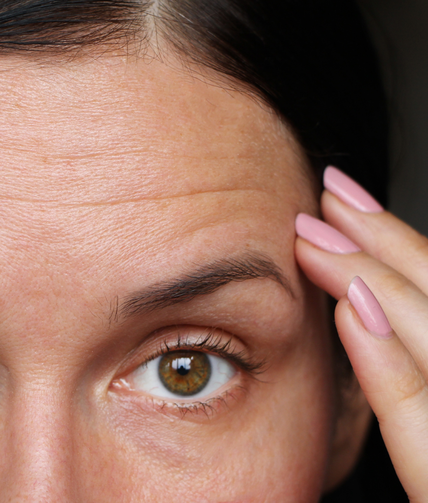 woman touching her forehead wrinkles