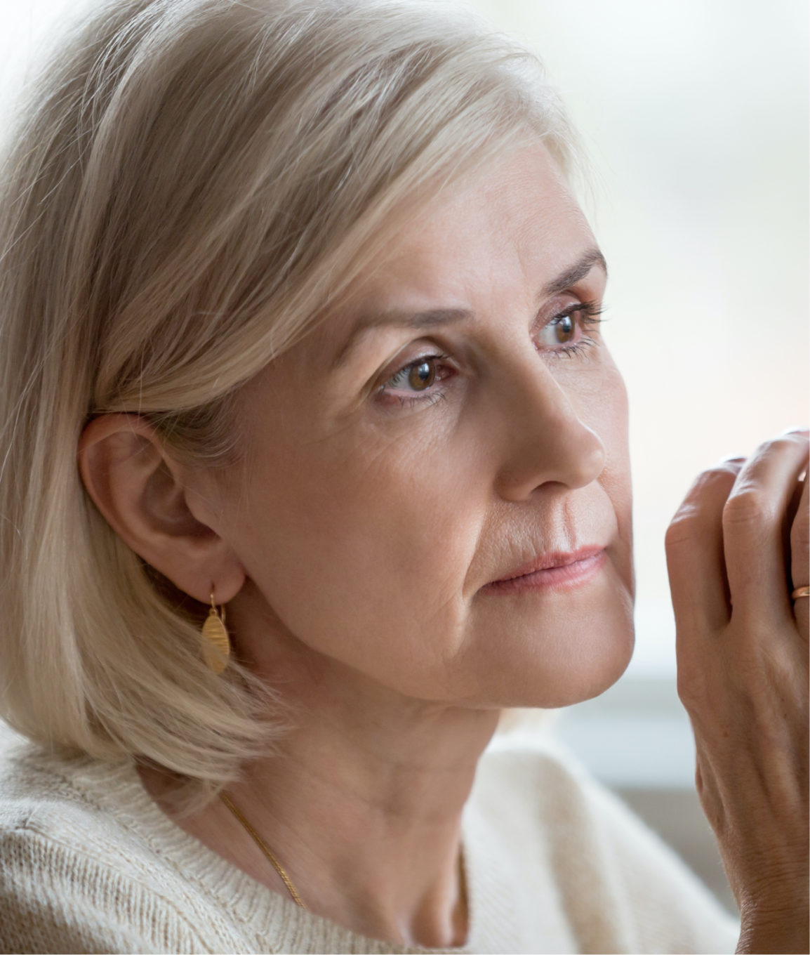 Woman with low facial volume