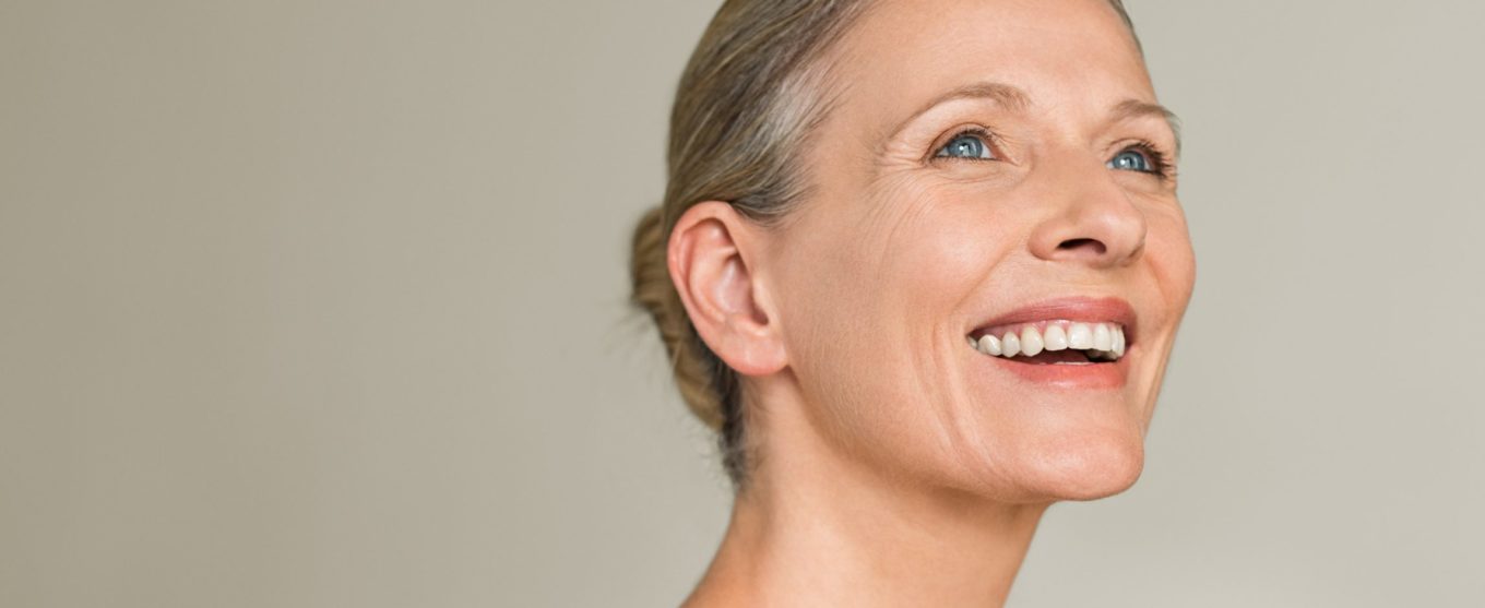 Smiling woman with facial volume loss
