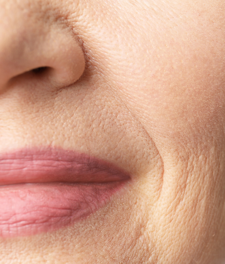 Close-up on fine lines and wrinkles on a woman's face